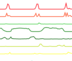 _images/basic-multiple-line-chart-thumb.png